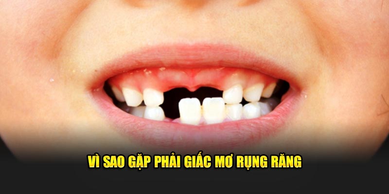 Vì sao gặp phải giấc mơ rụng răng